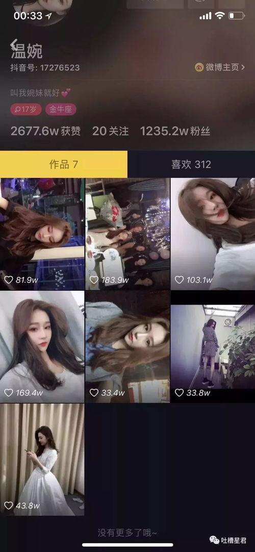 抖音网红吃瓜儿是谁